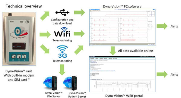 Overview Dyna-Vision